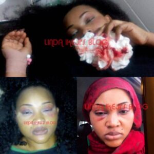 Battered Mercy Aigbe After Severe Beating From Husband, Lanre Gentry