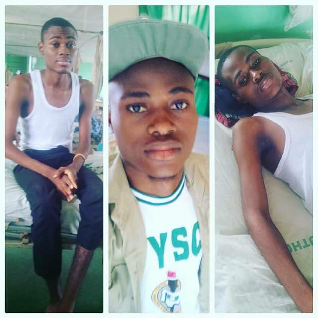 NYSC: Corper Member Serving In Kebbi Dies Of Anaemia