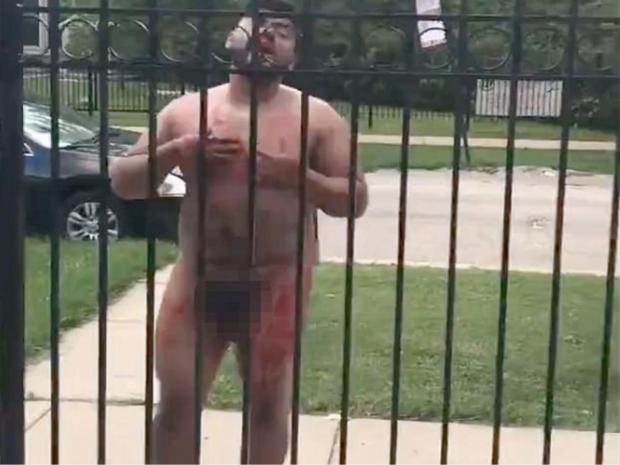 Naked man cuts off his penis and goes on rampage in Chicago (VIDEO)