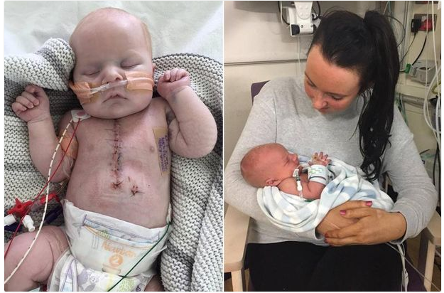 Baby With Heart That Stopped Three Times Reunites With His Family Photos