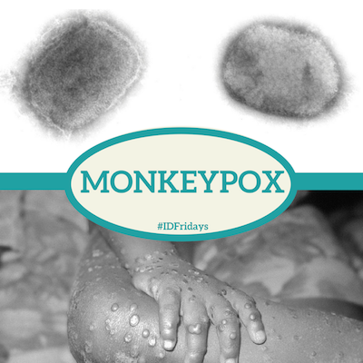 Seven Tips To Avoid Monkeypox
