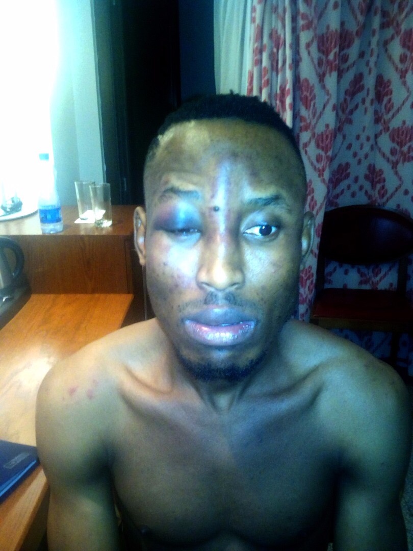 Singer Mr. 2Kay Robbed At Gun Point In Hotel Room At Eko Hotel, After Buckwyld & Breathless Concert