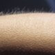 Goosebumps in Hot Weather: It Could Be a Warning Sign | Fab.ng