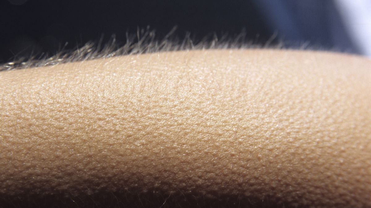 Goosebumps in Hot Weather: It Could Be a Warning Sign | Fab.ng